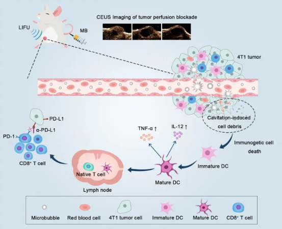 Low-intensity focused ultrasound targeted microbubble destruction reduces tumor blood supply and sensitizes anti-PD-L1 immunotherapy 配图
