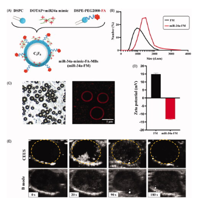 UTMD promoted local delivery of miR-34a-mimic for ovarian cancer therapy 配图