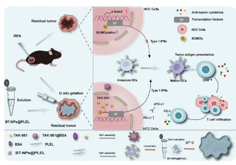 Targeting SUMOylation with an injectable nanocomposite hydrogel to optimize radiofrequency ablation therapy for hepatocellular carcinoma  配图
